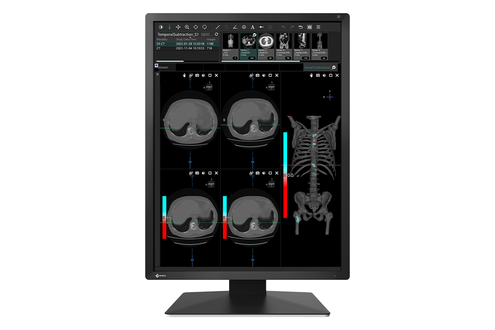 MX217 | RadiForce